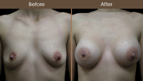 20202805155921_B85-Front